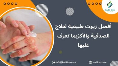 زيوت طبيعية لعلاج الصدفية والأكزيما